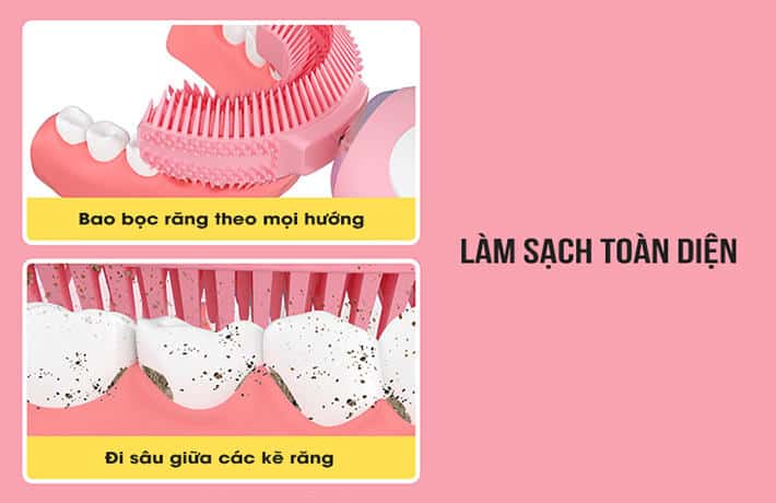 Bàn Chải Chữ U Là Gì? Có Nên Dùng Cho Bé Không? 1 ban-chai-chu-U-3